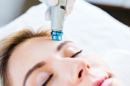 Hydra Facial